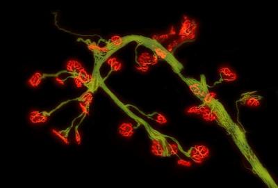 Leg muscle cell from an adult mouse model