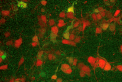 A fluorescent readout measuring neural network activity. Credit: Network of optogenetically addressable neurons and astrocytes: Sylvester James Gates III and Kate M. O'Neill.
