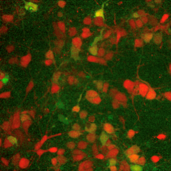 A fluorescent readout measuring neural network activity. Credit: Network of optogenetically addressable neurons and astrocytes: Sylvester James Gates III and Kate M. O'Neill.