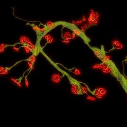 Leg muscle cell from an adult mouse model